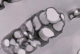 Bacteria permite producir plástico biodegradable