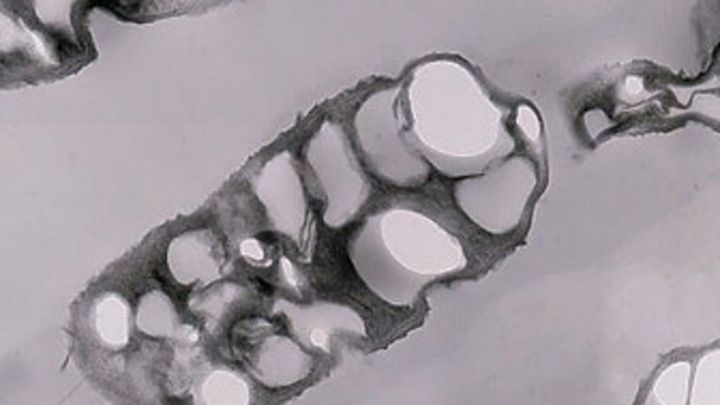 Bacteria permite producir plástico biodegradable