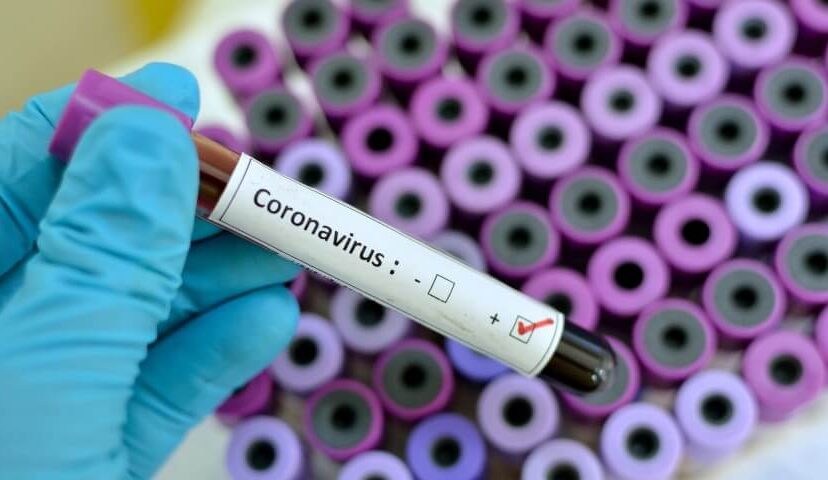 Salud planetaria y el coronavirus