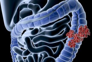 Microbiota intestinal humana