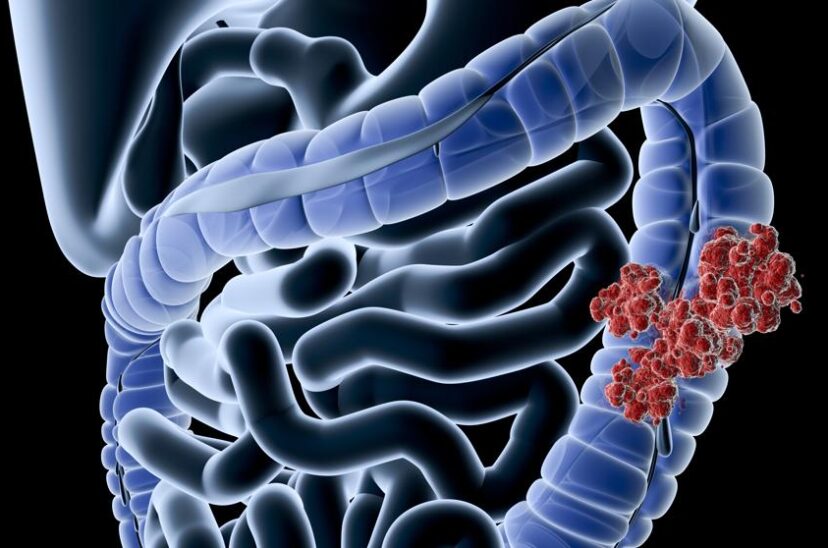 Microbiota intestinal humana