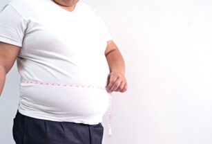 obesidad